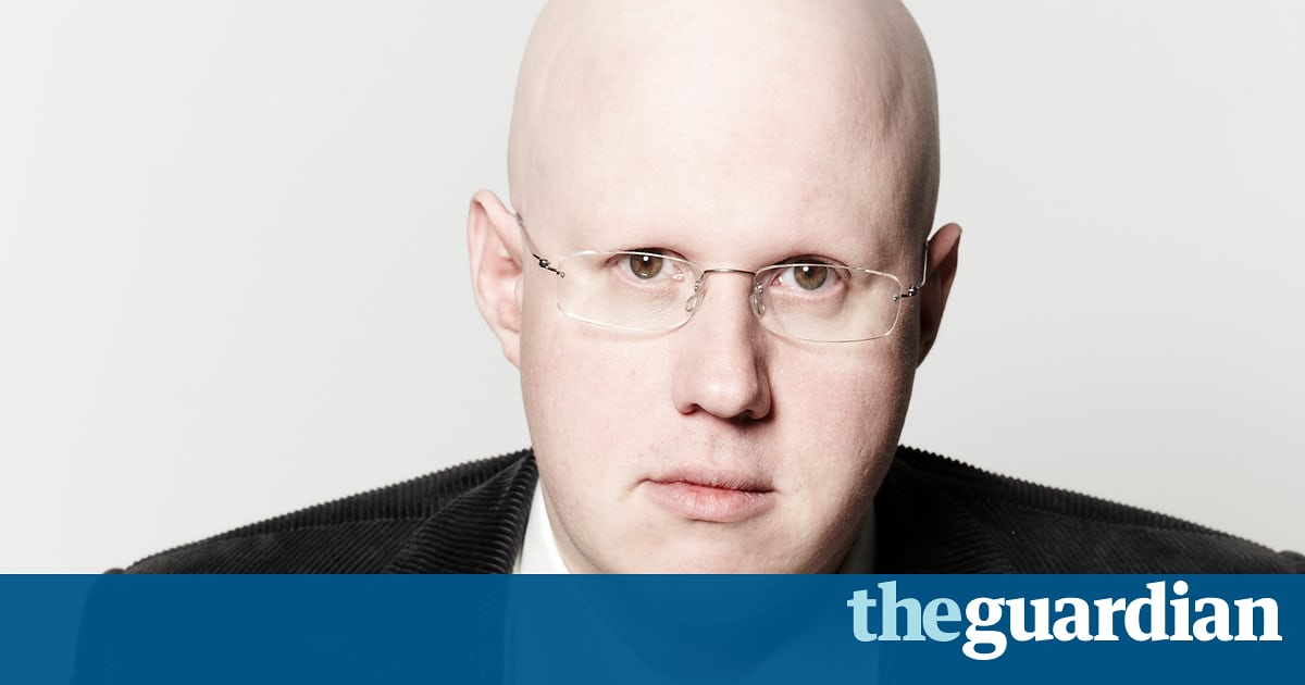 Matt Lucas: Losing my hair at the age of six shaped my life